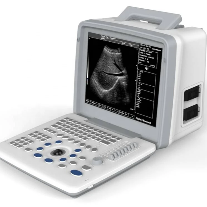 Potable Ultrasound Machine